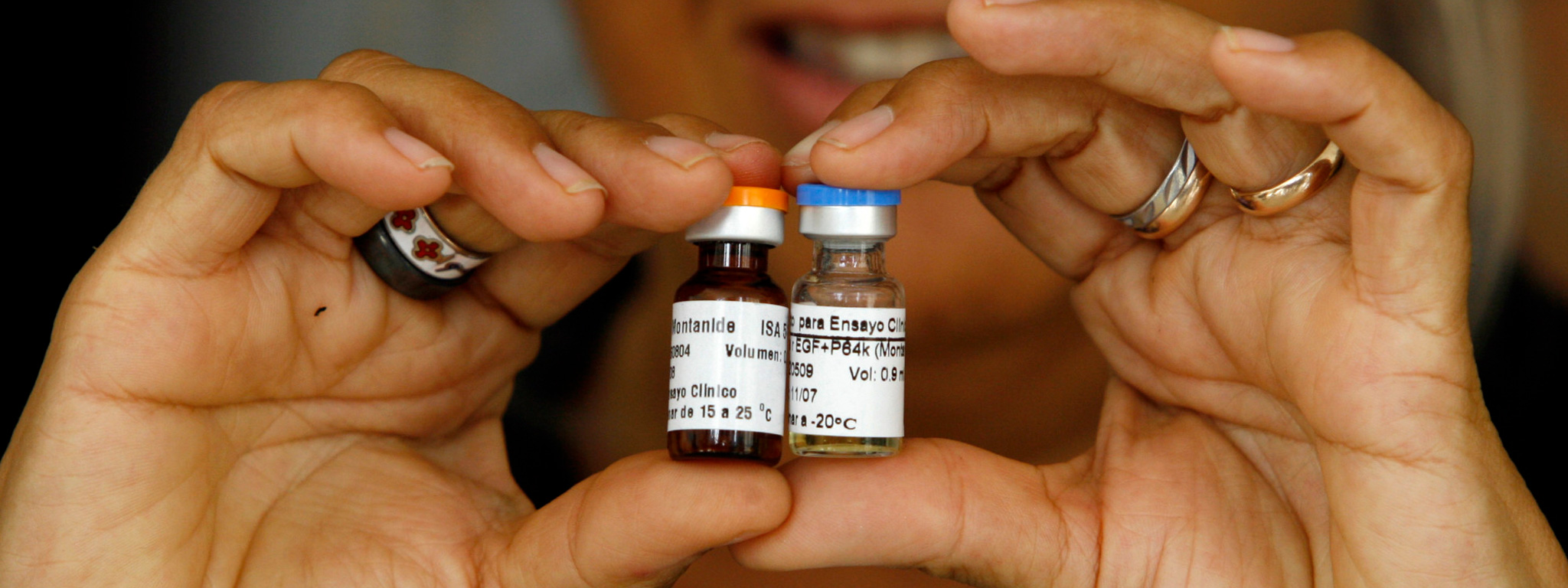 Vaccine ung thư phổi của Cuba bắt đầu được thử nghiệm tại Mỹ